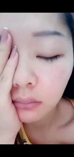 眼睛又肿了/调戏/调